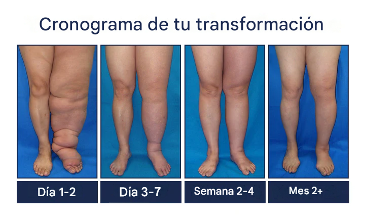 Kubozn🌿¡Crema para drenaje linfático y alivio de la hinchazón! Elimina el dolor y la rigidez Promo 45%Off